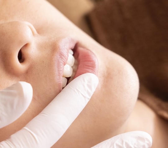 スマートデント2と white w star gel2 箱あり スマートデント 16